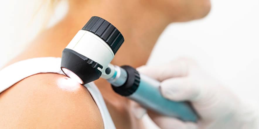 skin cancer screening los angeles