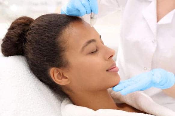 microneedling treatment los angeles 2