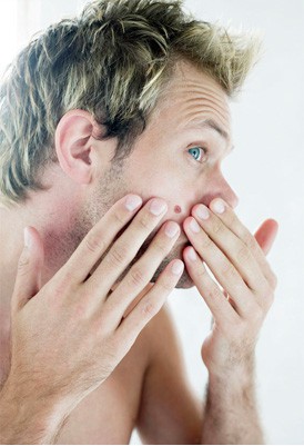 squamous cell carcinoma information