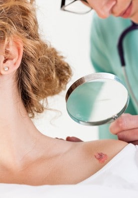 dermatologist looking at actinic keratosis on a patient's shoulder