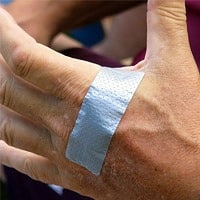 duct tape wart removal