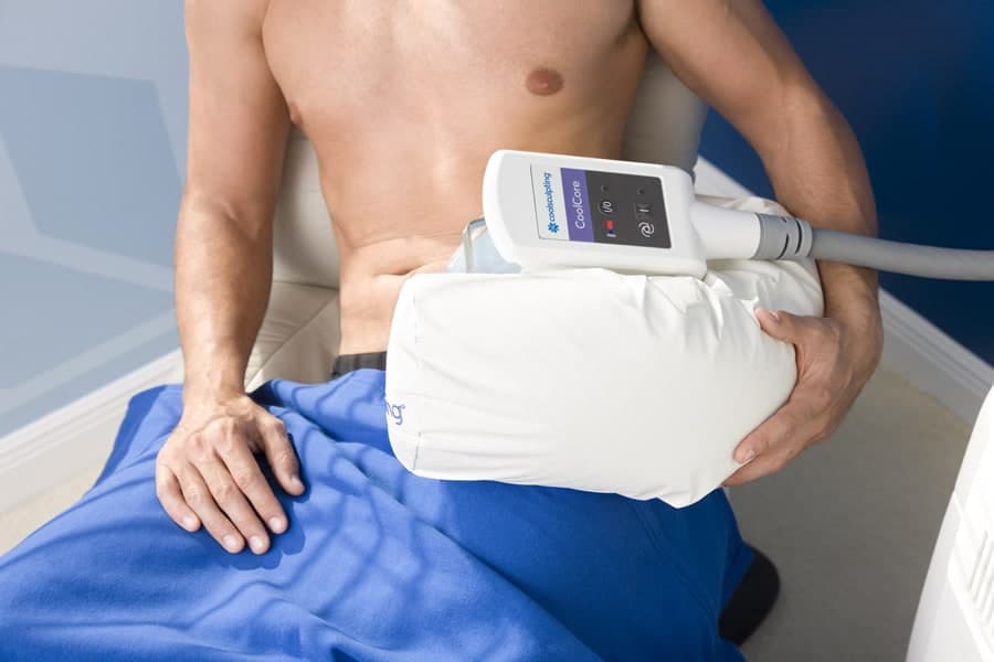 image of a male patient undergoing coolsculpting on the body